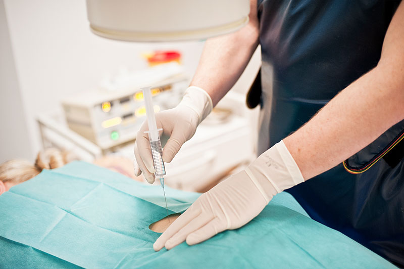 thermokoagulation